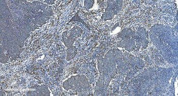 TIMM8A/DDP Antibody