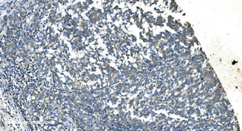 TIMM8A/DDP Antibody