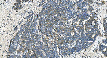 TIMM8A/DDP Antibody