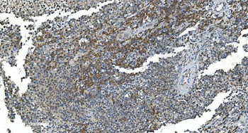 TIMM8A/DDP Antibody