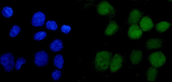ANAPC2 Rabbit Polyclonal Antibody
