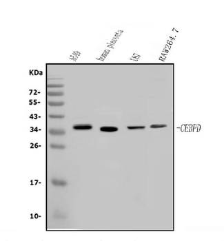 CEBP Delta/CEBPD Rabbit Polyclonal Antibody