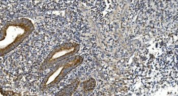 NOX2/gp91phox/CYBB Antibody