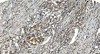 NOX2/gp91phox/CYBB Antibody