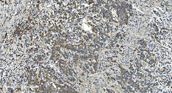 NOX2/gp91phox/CYBB Antibody