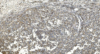 NOX2/gp91phox/CYBB Antibody