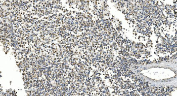 NOX2/gp91phox/CYBB Antibody