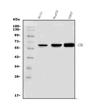 NOX2/gp91phox/CYBB Antibody