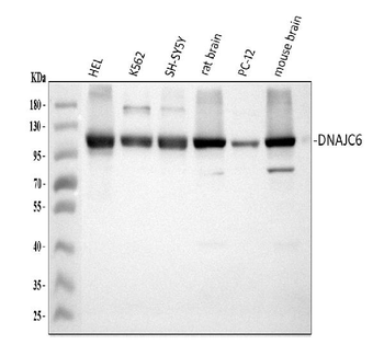 DNAJC6 Rabbit Polyclonal Antibody