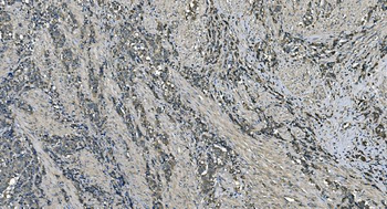 DNAJC10 Rabbit Polyclonal Antibody