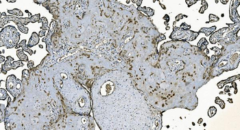 DNAJC10 Rabbit Polyclonal Antibody