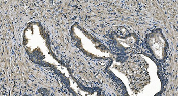 DNAJC10 Rabbit Polyclonal Antibody