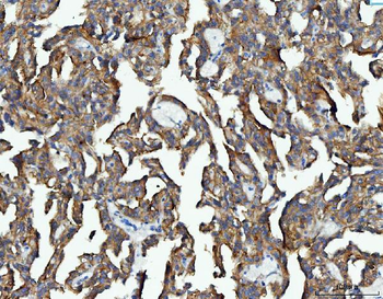 EEF2 Antibody