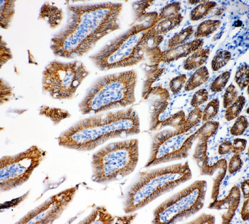 EpCAM Rabbit Polyclonal Antibody