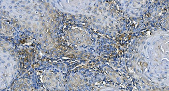 GABARAP Antibody