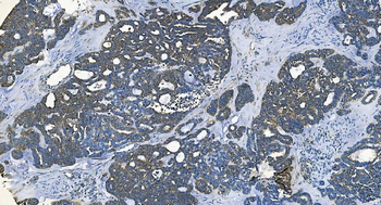 GABARAP Antibody