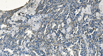 GABARAP Antibody