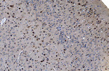 GABARAP Antibody