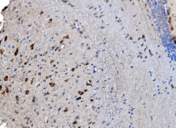 GABARAP Antibody