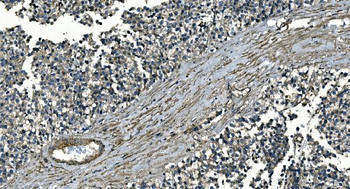 GNG7 Antibody