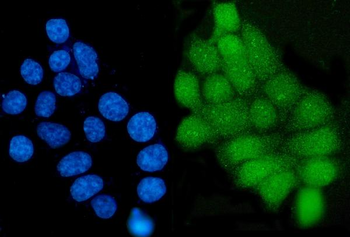 Grainyhead-like protein 1/GRHL1 Rabbit Polyclonal Antibody
