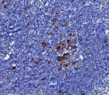 IL-21/Il21 Antibody