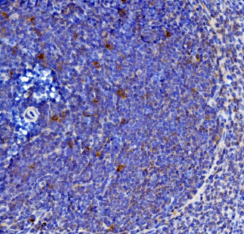 IL-21/Il21 Antibody