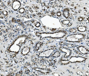 METTL1 Antibody
