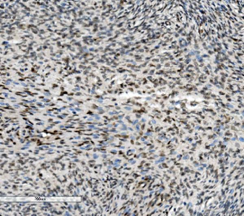 METTL1 Antibody