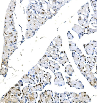 METTL1 Antibody