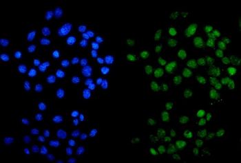 METTL14 Rabbit Polyclonal Antibody