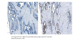 METTL14 Rabbit Polyclonal Antibody