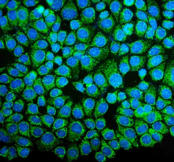 NDUFB10 Antibody