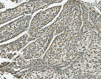 NDUFB10 Antibody