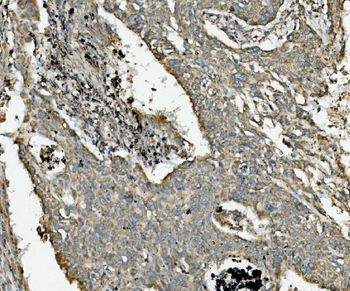 NDUFB10 Antibody