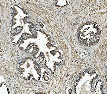 NDUFB10 Antibody