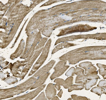 NDUFB10 Antibody