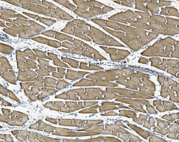 NDUFB10 Antibody