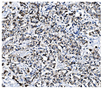 PCBP1 Antibody