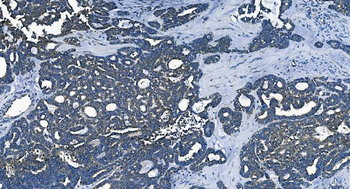 PCBP2/hnRNP E2 Rabbit Polyclonal Antibody