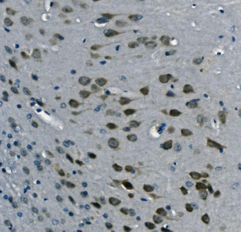 PCBP2/hnRNP E2 Rabbit Polyclonal Antibody