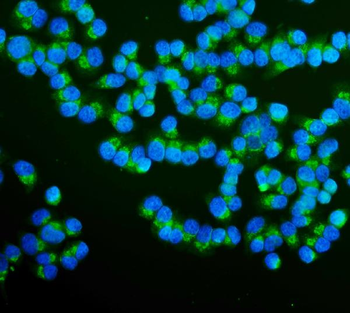 RAB1B Antibody