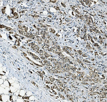 RAB1B Antibody