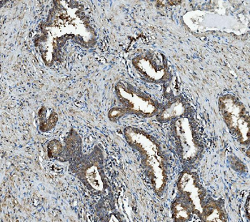 RAB1B Antibody
