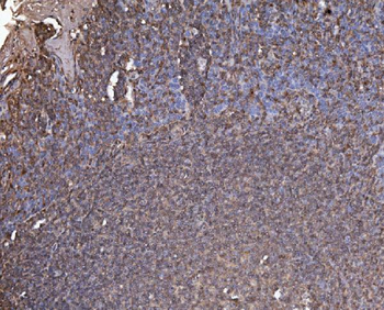 RAB1B Antibody