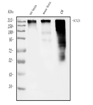 SCN2A Rabbit Polyclonal Antibody
