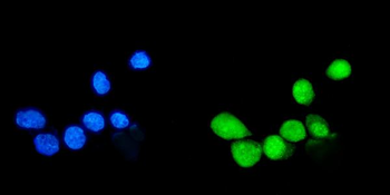 Sumo 1/SUMO1 Antibody