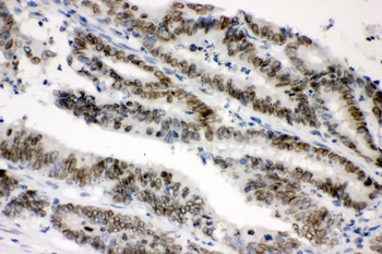 Sumo 1/SUMO1 Antibody