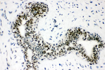 Sumo 1/SUMO1 Antibody