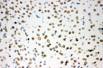 Sumo 1/SUMO1 Antibody